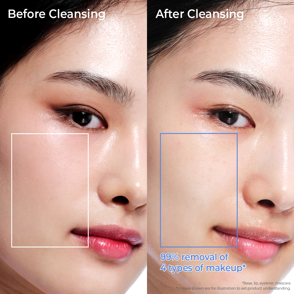 Before and after comparison of skin improvement with Aestura cream