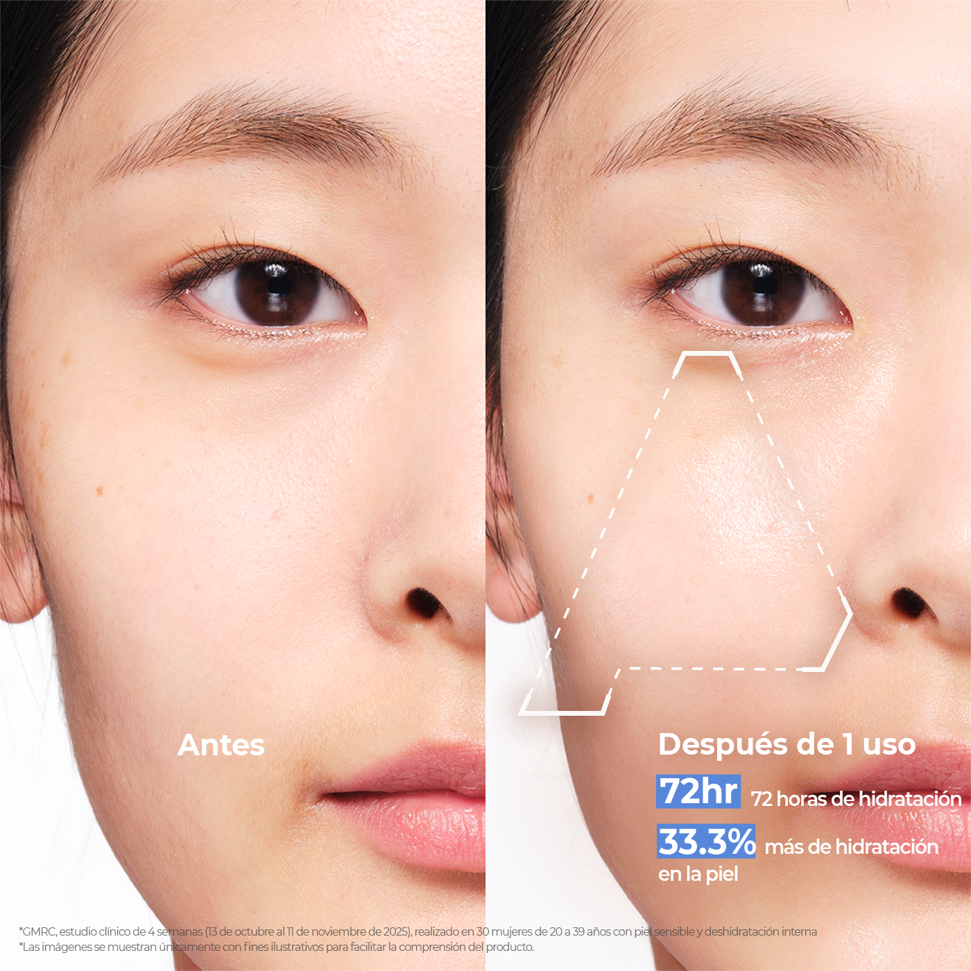 Before and after comparison of skin improvement with Aestura cream