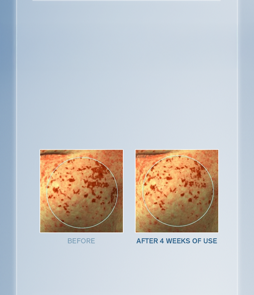 Sulwhasoo,International,<p><span style="color: rgb(47, 99, 139)"><strong>100%**</strong></span></p><p><span style="color: rgb(0, 0, 0)"><sub>showed visible improvement in</sub></span></p><p><span style="color: rgb(0, 0, 0)"><strong>DARK SPOTS</strong></span></p><p><span style="color: rgb(0, 0, 0)"><strong>OVER TIME</strong></span></p><p><span style="color: rgb(0, 0, 0)"><sup>(more than 5 years)</sup></span></p><p></p><p></p><p></p><p></p><p></p>