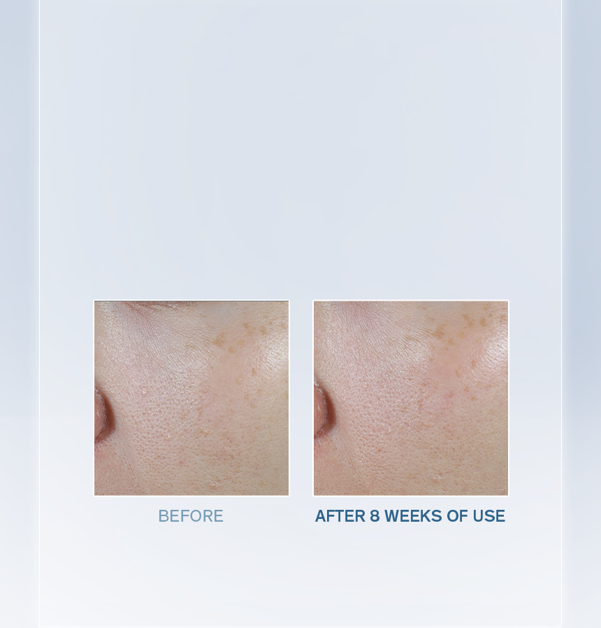 Sulwhasoo,Malaysia,<p><span style="color: rgb(47, 99, 139)"><strong>93.5%</strong></span></p><p><span style="color: rgb(0, 0, 0)"><sub>showed improvement in</sub></span></p><p><span style="color: rgb(0, 0, 0)"><strong>VISIBLE GLOW</strong></span></p><p></p><p></p><p></p><p></p><p></p>