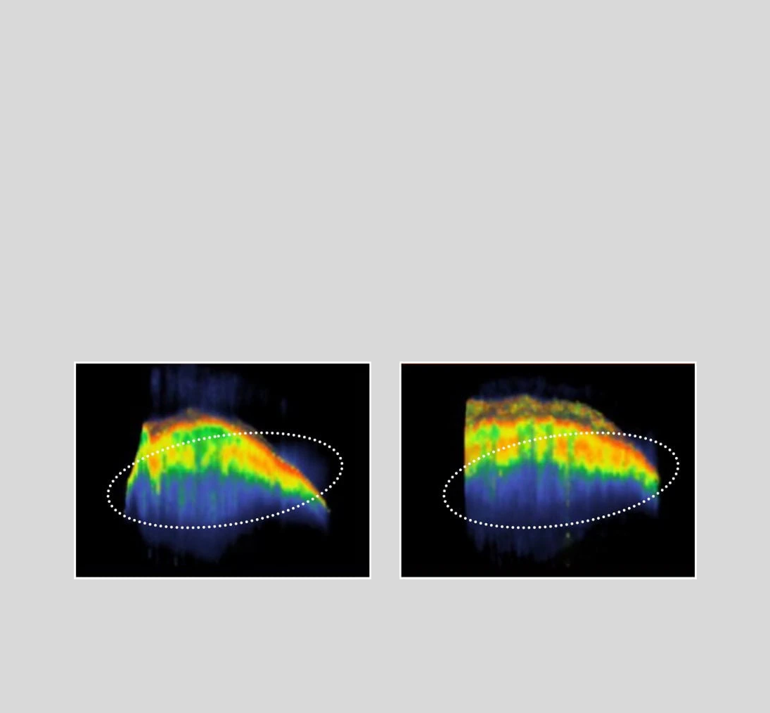 Sulwhasoo,Indonesia,<p><span style="color: rgb(0, 0, 0)"><strong>KEPADATAN LAPISAN</strong></span></p><p><span style="color: rgb(0, 0, 0)"><strong>ELASTISITAS KULIT</strong></span></p>