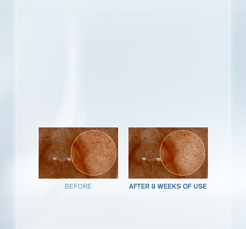 Sulwhasoo,Malaysia,<p><span style="color: rgb(47, 99, 139)"><strong>87.0%</strong></span></p><p><span style="color: rgb(0, 0, 0)"><sub>showed improvement in</sub></span></p><p><span style="color: rgb(0, 0, 0)"><strong>VISIBLE SPOTS</strong></span></p><p></p><p></p><p></p><p></p>