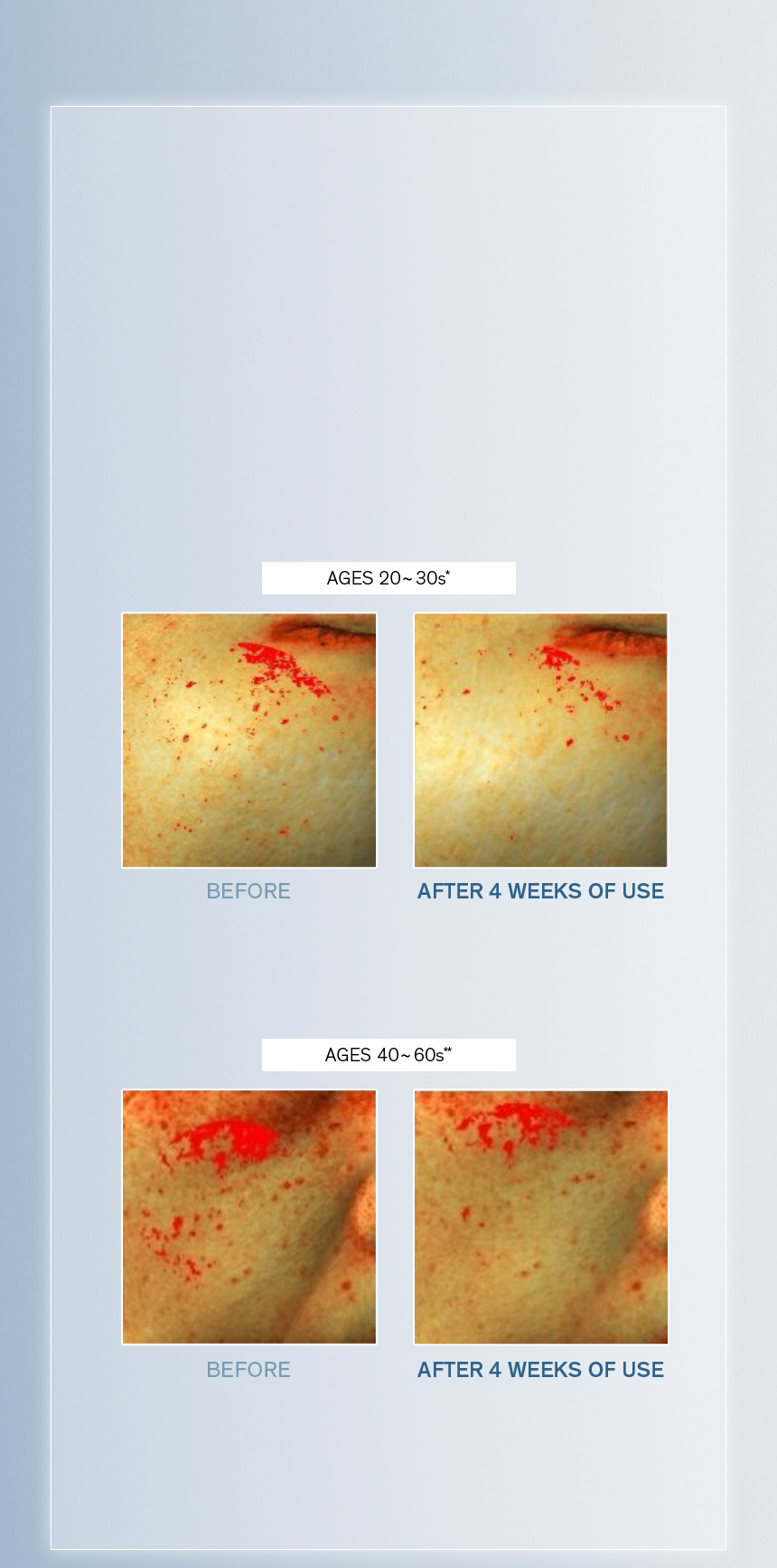 Sulwhasoo,International,<p><span style="color: rgb(47, 99, 139)"><strong>100%</strong></span></p><p><span style="color: rgb(0, 0, 0)"><sub>showed visible improvement in</sub></span></p><p><span style="color: rgb(0, 0, 0)"><strong>DARK SPOTS</strong></span></p><p></p>