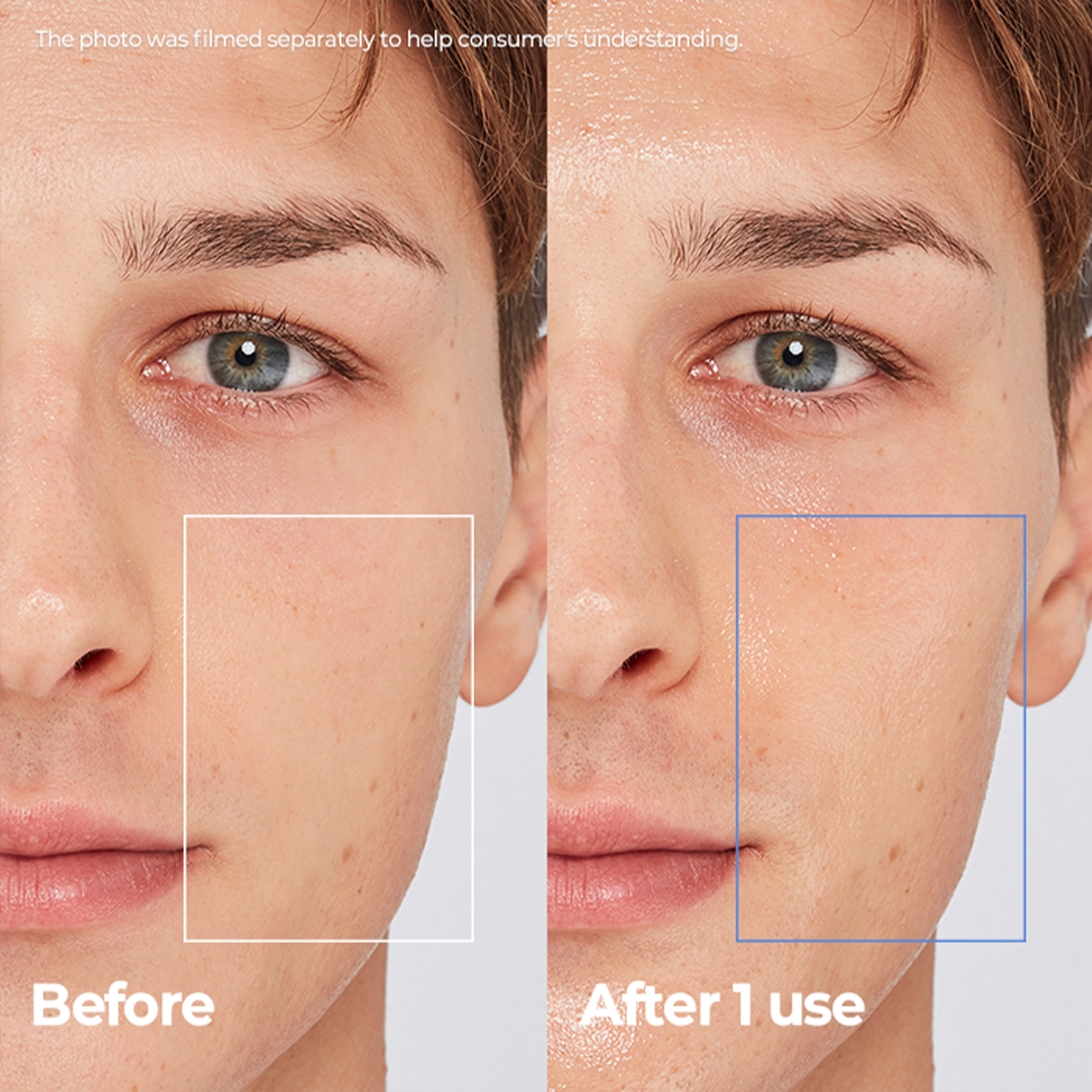 Before and after comparison showing skin change after one use