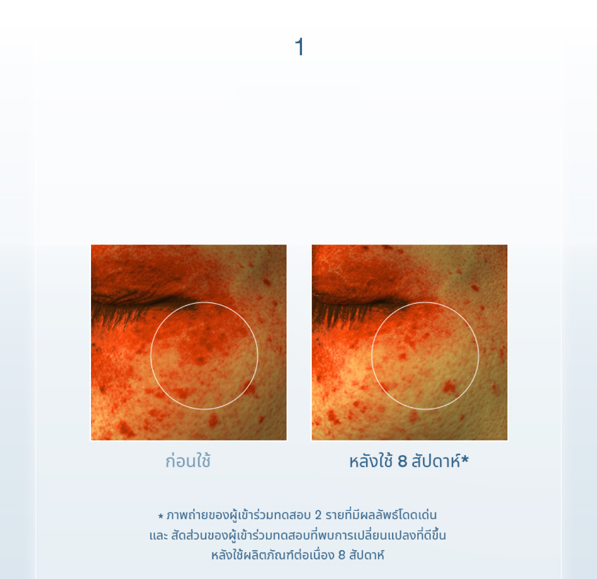 Sulwhasoo,Thailand,<p><span style="color: rgb(47, 99, 139)"><strong>100%</strong></span></p><p><span style="color: rgb(0, 0, 0)"><sub>พบการเปลี่ยนแปลงที่ดีขึ้นอย่างเห็นได้ชัด</sub></span></p><p><span style="color: rgb(0, 0, 0)"><strong>ในปัญหาสีผิวหมองคล้ำ*</strong></span></p><p></p><p></p><p></p><p></p><p></p><p></p>
