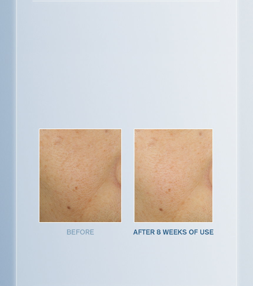 Sulwhasoo,Malaysia,<p><span style="color: rgb(47, 99, 139)"><strong>100%</strong></span></p><p><span style="color: rgb(0, 0, 0)"><sub>showed visible improvement in</sub></span></p><p><span style="color: rgb(0, 0, 0)"><strong>SKIN TONE </strong><sub>(BRIGHTNESS)</sub></span></p><p></p><p></p><p></p><p></p><p></p><p></p>