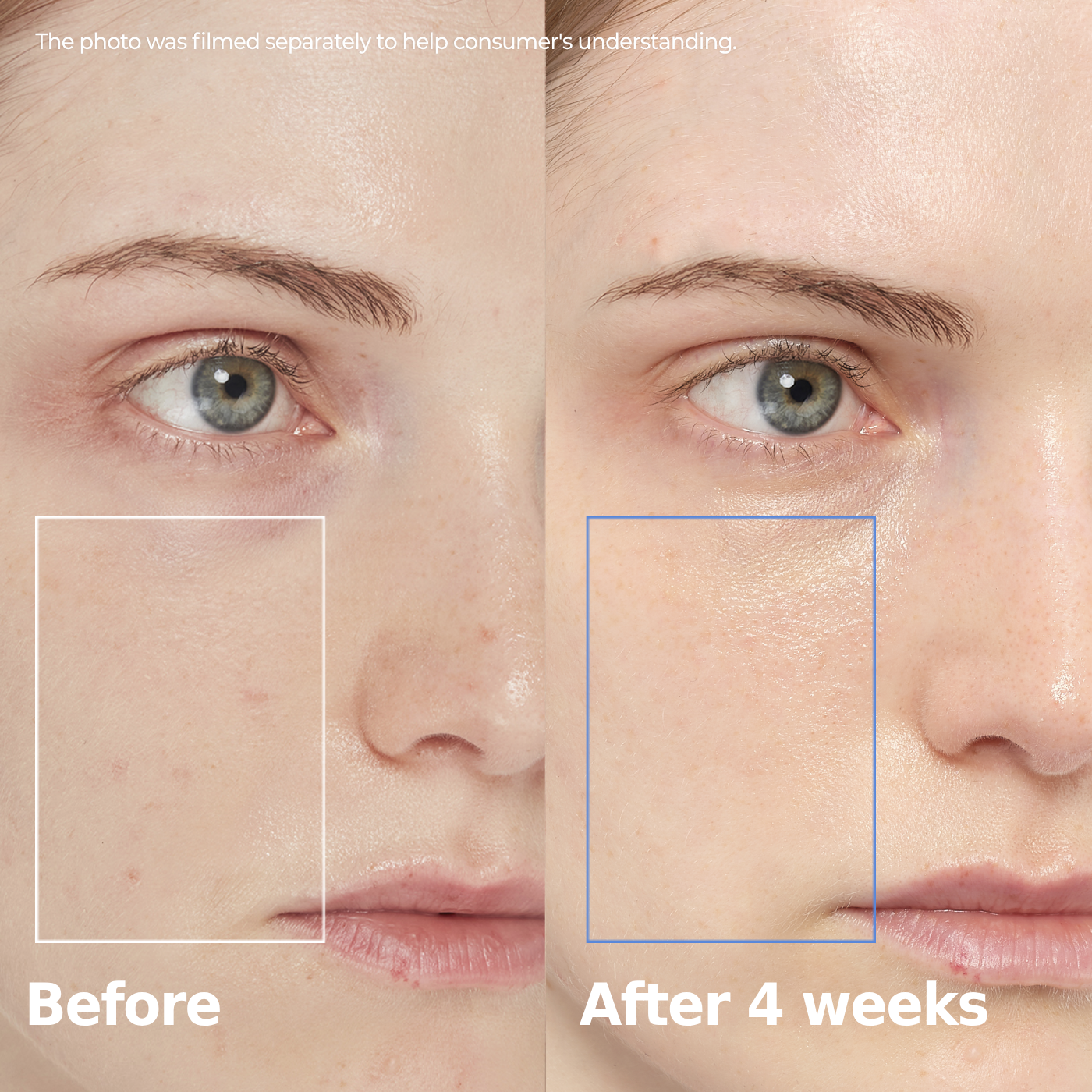 Before and after comparison showing skin improvement after 4 weeks use
