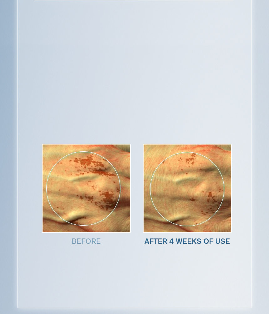 Sulwhasoo,International,<p><span style="color: rgb(47, 99, 139)"><strong>90.0%**</strong></span></p><p><span style="color: rgb(0, 0, 0)"><sub>showed visible improvement in</sub></span></p><p><span style="color: rgb(0, 0, 0)"><strong>DARK SPOTS</strong></span></p><p><span style="color: rgb(0, 0, 0)"><strong>ON THE HAND</strong></span></p><p></p><p></p><p></p><p></p>