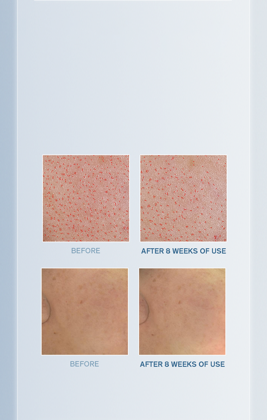 Sulwhasoo,International,<p><span style="color: rgb(47, 99, 139)"><strong>100%</strong></span></p><p><span style="color: rgb(0, 0, 0)"><sub>showed visible improvement in</sub></span></p><p><span style="color: rgb(0, 0, 0)"><strong>BRIGHTNESS</strong></span></p><p><span style="color: rgb(0, 0, 0)"><strong>OF PORE AREA</strong></span></p><p></p><p></p><p></p><p></p><p></p><p></p><p></p><p></p><p></p><p></p>