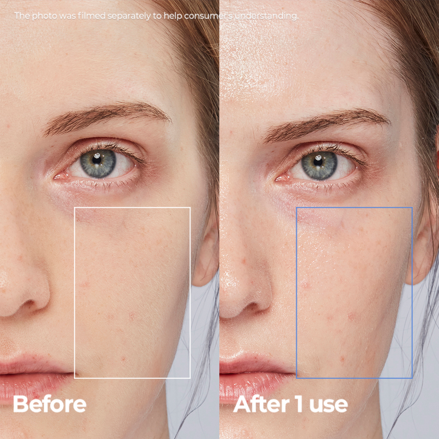 Before and after comparison showing skin improvement with Aestura cream