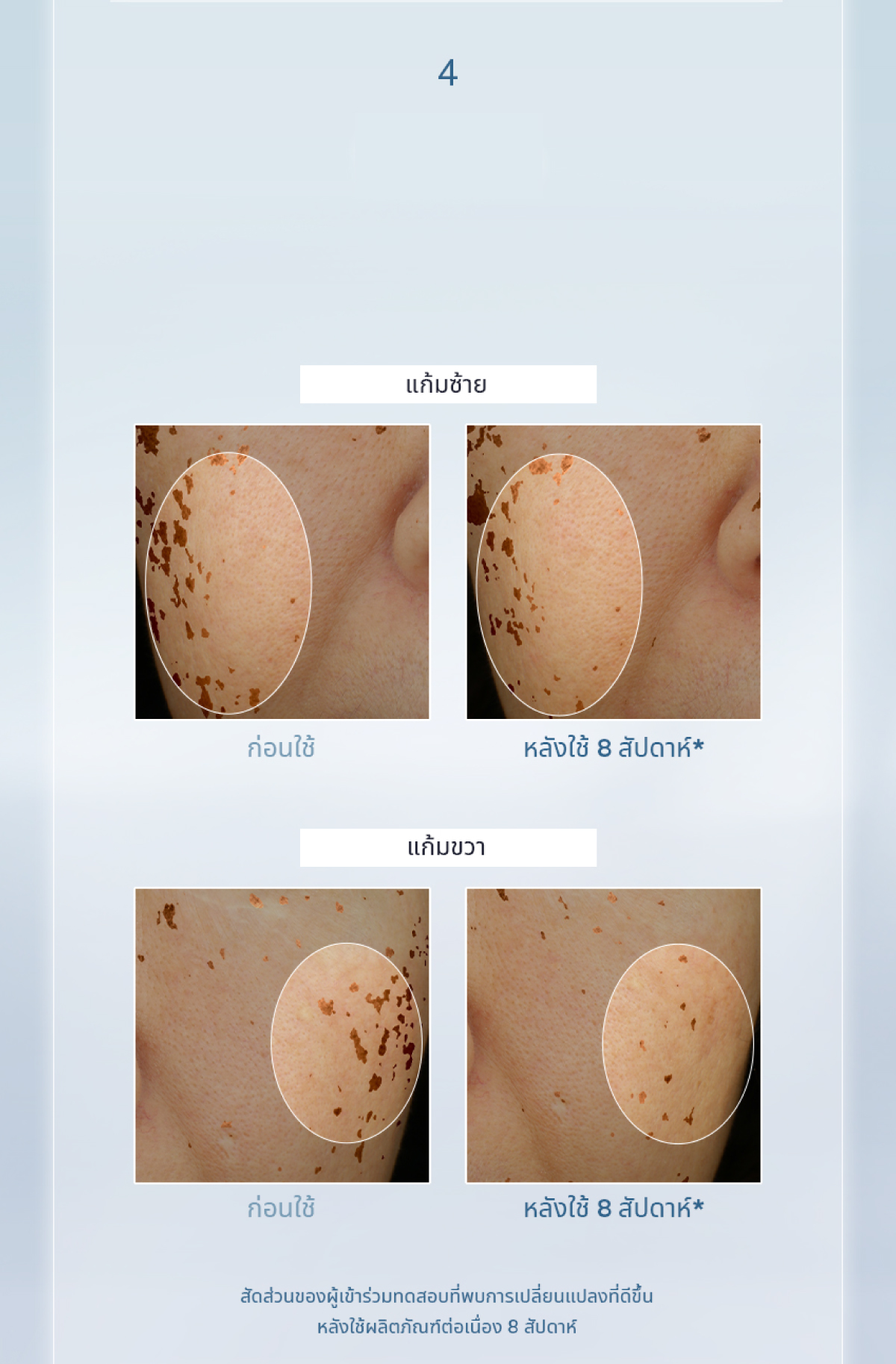 Sulwhasoo,Thailand,<p><span style="color: rgb(47, 99, 139)"><strong>96.7%</strong></span></p><p><span style="color: rgb(0, 0, 0)"><sub>พบการเปลี่ยนแปลงที่ดีขึ้นอย่างเห็นได้ชัด</sub></span></p><p><span style="color: rgb(0, 0, 0)"><strong>ในระดับเมลานิน</strong></span></p><p></p><p></p><p></p><p></p>