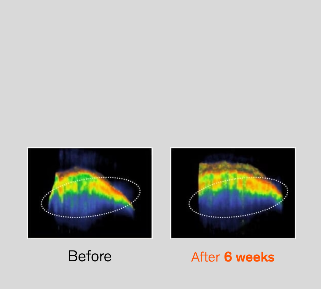 Sulwhasoo,Hong Kong,<p><span style="color: rgb(0, 0, 0)"><strong>DENSITY OF SKIN’S</strong></span></p><p><span style="color: rgb(0, 0, 0)"><strong>ELASTIC LAYER</strong></span></p>