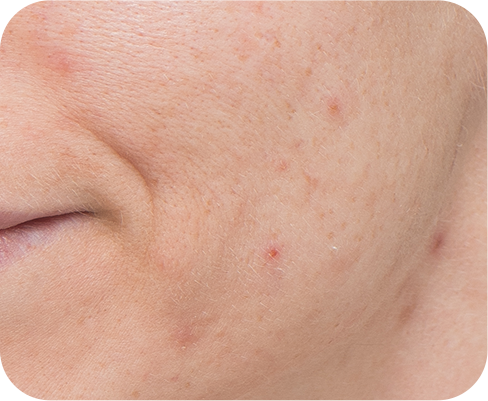 LANEIGE,International