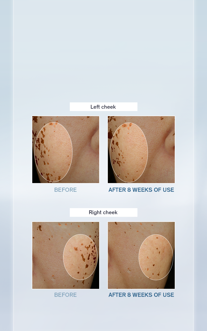 Sulwhasoo,Malaysia,<p><span style="color: rgb(47, 99, 139)"><strong>96.7%</strong></span></p><p><span style="color: rgb(0, 0, 0)"><sub>showed improvement in</sub></span></p><p><span style="color: rgb(0, 0, 0)"><strong>VISIBLE DARK SPOTS</strong></span></p><p></p><p></p><p></p><p></p><p></p><p></p><p></p><p></p><p></p><p></p><p></p><p></p>