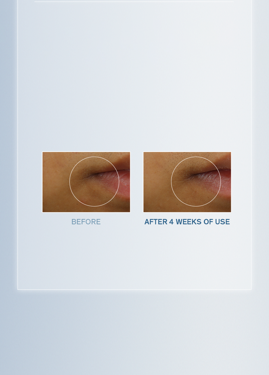 Sulwhasoo,International,<p><span style="color: rgb(47, 99, 139)"><strong>90.6%*</strong></span></p><p><span style="color: rgb(0, 0, 0)"><sub>showed visible improvement in</sub></span></p><p><span style="color: rgb(0, 0, 0)"><strong>PIGMENTATION</strong></span></p><p><span style="color: rgb(0, 0, 0)"><strong>ALONG THE LIP LINE</strong></span></p><p></p>