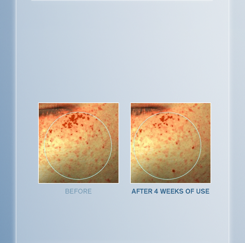 Sulwhasoo,International,<p><span style="color: rgb(47, 99, 139)"><strong>90.6%*</strong></span></p><p><span style="color: rgb(0, 0, 0)"><sub>showed visible improvement in</sub></span></p><p><span style="color: rgb(0, 0, 0)"><strong>DARK PIGMENTATION</strong></span></p><p></p><p></p><p></p><p></p><p></p>