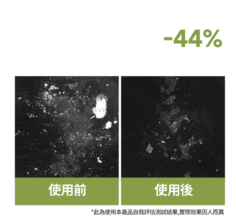 RYO,Taiwan,<p><span style="color: black">頭皮角質量</span></p>