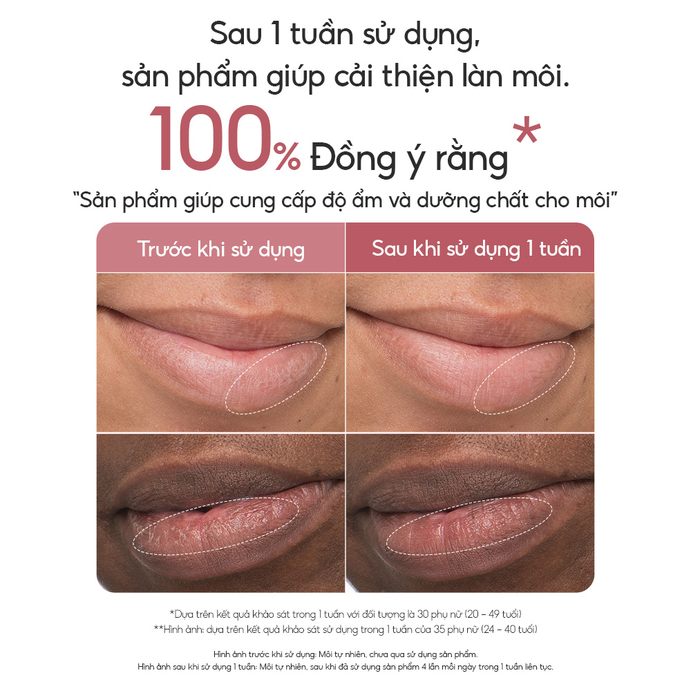 [HOT] Son Dưỡng Có Màu, Môi Căng Bóng Rạng Rỡ Laneige Glaze Craze Tinted Lip Serum