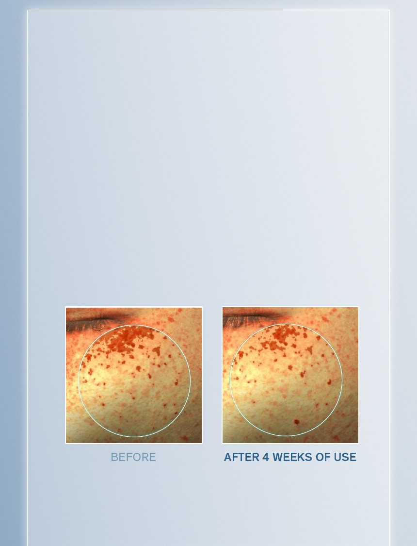 Sulwhasoo,International,<p><span style="color: rgb(47, 99, 139)"><strong>93.7%*</strong></span></p><p><span style="color: rgb(0, 0, 0)"><sub>showed visible improvement in</sub></span></p><p><span style="color: rgb(0, 0, 0)"><strong>LIGHT PIGMENTATION</strong></span></p><p></p><p></p><p></p><p></p><p></p>