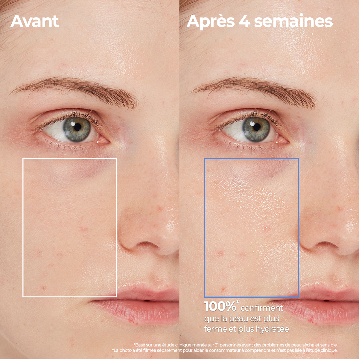 Before and after comparison showing skin improvement after 4 weeks use