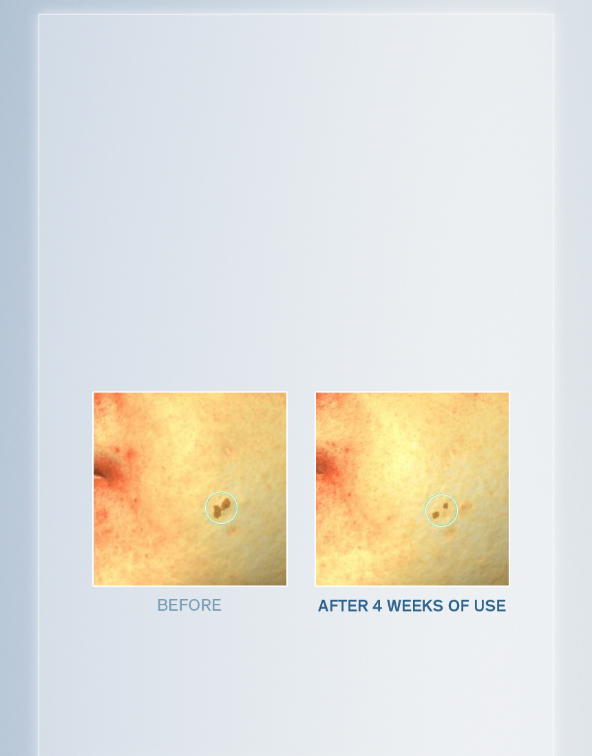 Sulwhasoo,International,<p><span style="color: rgb(47, 99, 139)"><strong>84.3%*</strong></span></p><p><span style="color: rgb(0, 0, 0)"><sub>showed visible improvement in</sub></span></p><p><span style="color: rgb(0, 0, 0)"><strong>POST-BLEMISH MARKS***</strong></span></p><p></p><p></p><p></p><p></p><p></p>