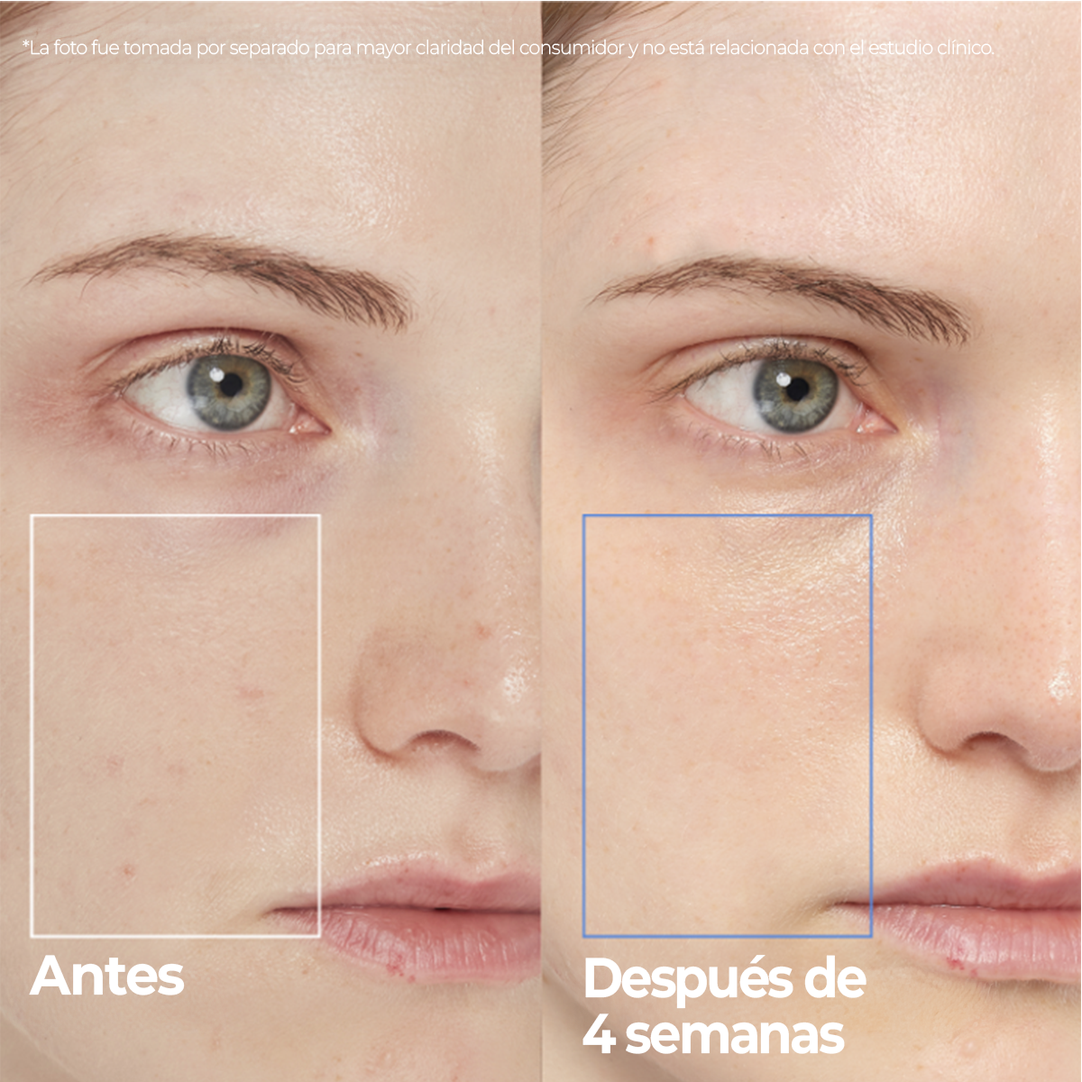 Before and after comparison showing skin improvement after 4 weeks use