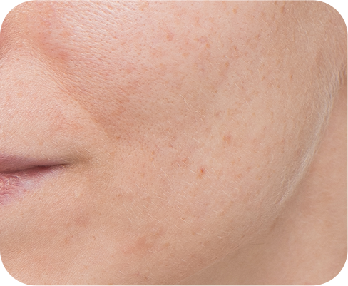 LANEIGE,International