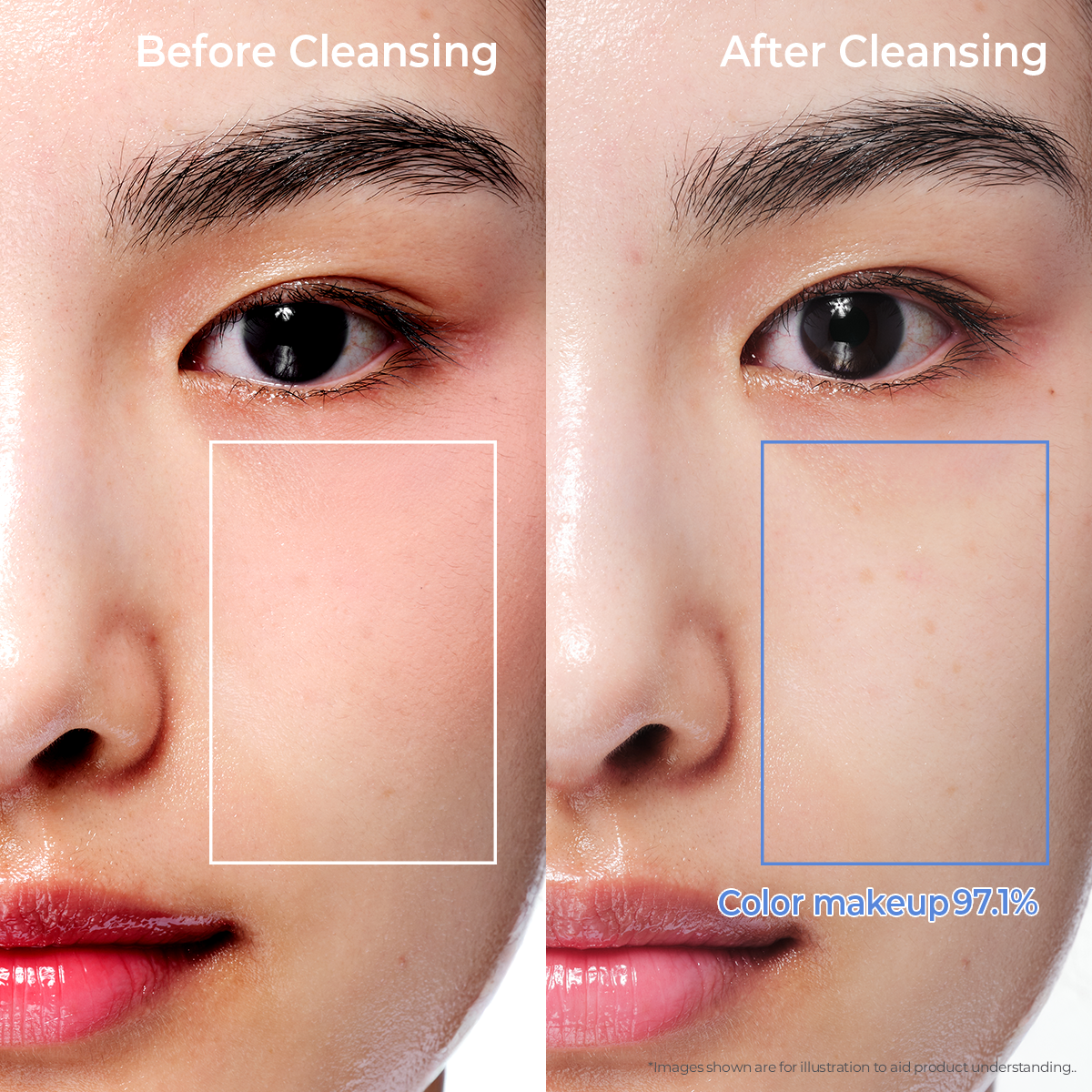 Before and after comparison of skin improvement with Aestura cream