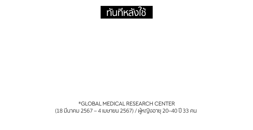 HERA,Thailand,<p><span style="color: rgb(7, 2, 2)"><strong>-76.7%</strong></span></p>